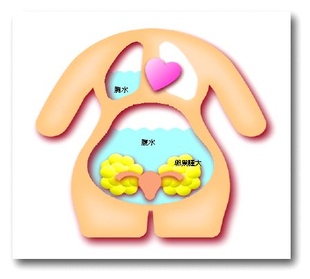 張る 排卵 期 お腹 頭痛やお腹の張り…排卵期の症状まとめ｜nunonaの布ナプキン